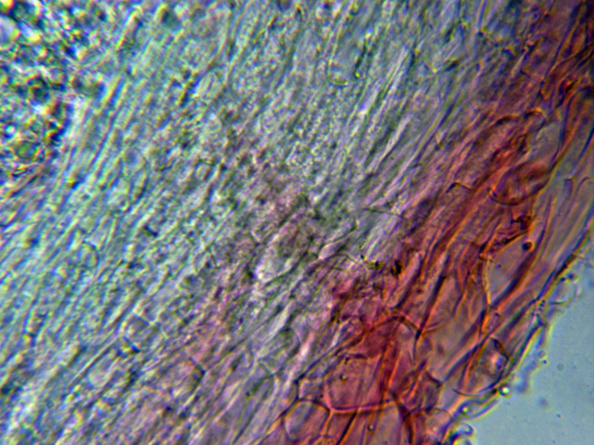 Microscopía de Phloeomana alba - 10 - Sección pileipellis
